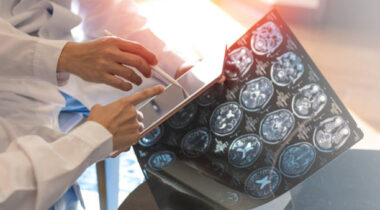 MRI digital x-ray of brain with team radiologist doctor oncology working together in clinic hospital. Medical healthcare concept.