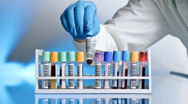 hand of a doctor taking a blood sample tube