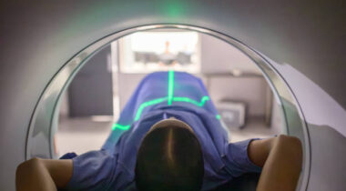 A patient positioned inside a modern CT scanner, illuminated by alignment lasers, undergoing a diagnostic scan. The setting is clinical, emphasizing precision, health care, and medical technology. This image portrays the importance of advanced medical tools in diagnosing and treating patients efficiently.